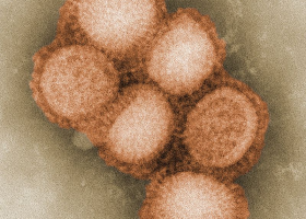 Plošná epidemie chřipky byla vyhlášena hlavní hygieničkou v ČR. Nemocných přibývá